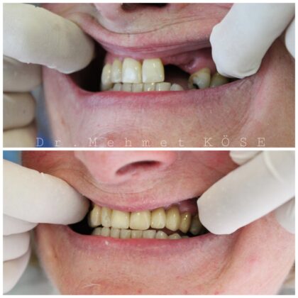 Adaport Dental Clinic