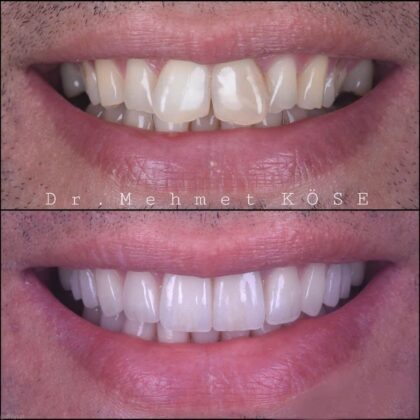 Adaport Dental Clinic