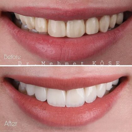 Adaport Dental Clinic