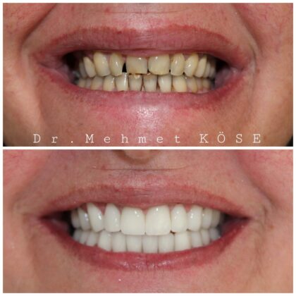 Adaport Dental Clinic