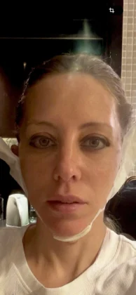 VG Plastic Surgery