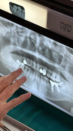 Bangkok Dental Spa