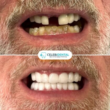 Celebi Dental Clinics