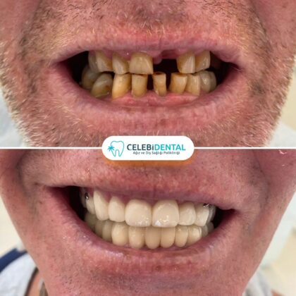 Celebi Dental Clinics