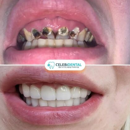 Celebi Dental Clinics