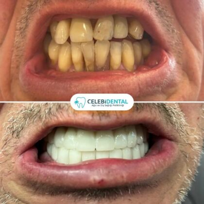 Celebi Dental Clinics