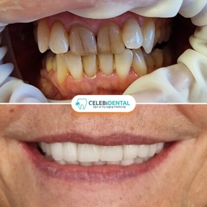 Celebi Dental Clinics
