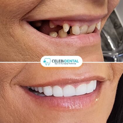 Celebi Dental Clinics