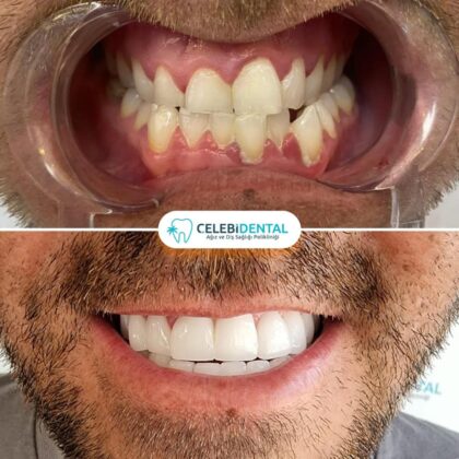 Celebi Dental Clinics