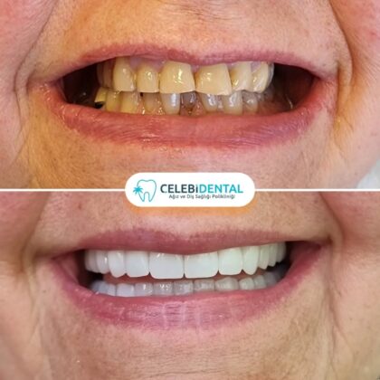 Celebi Dental Clinics