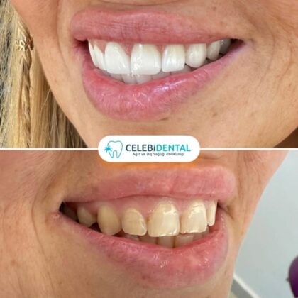 Celebi Dental Clinics