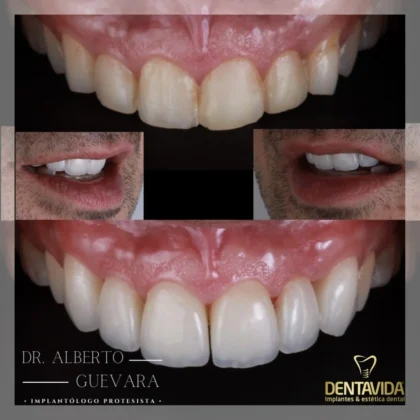 Dentavida Clinic