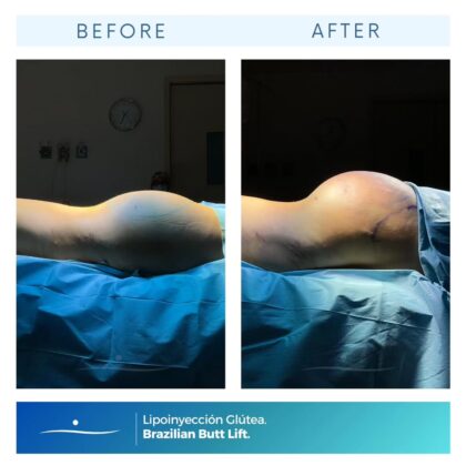 Riviera Institute For Plastic Surgery
