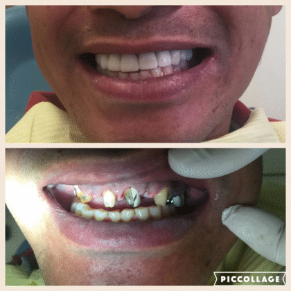Laredo Smile Center