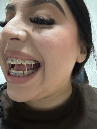 I love mydentist