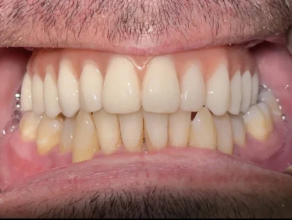 Thantakit International Dental Center