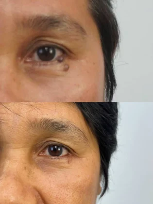 MAXi Cosmetic Surgery