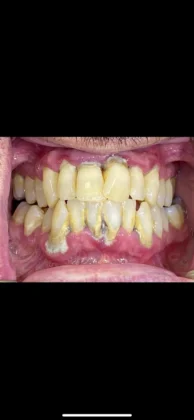 Thantakit International Dental Center