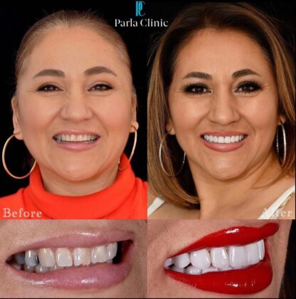 Parla Clinic