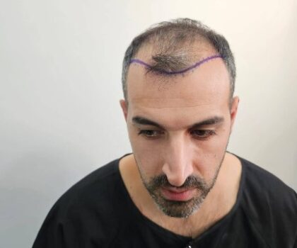 Mehmet Güçlü