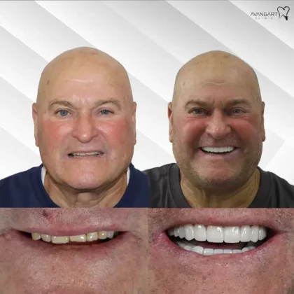 Avangart Dental Clinic