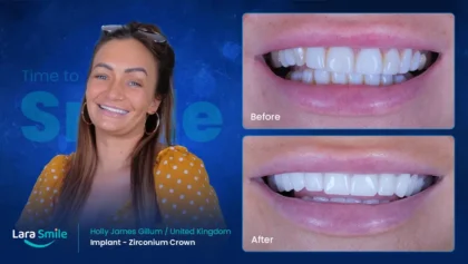 Lara Smile Dental Clinic