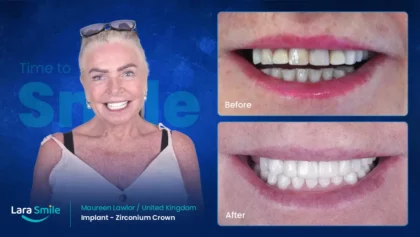 Lara Smile Dental Clinic