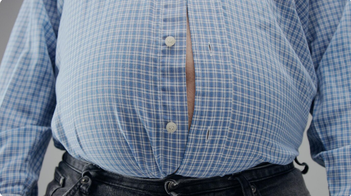 Gastric Sleeve Operation: A Life-Changing Weight Loss Journey Through Medical Travel