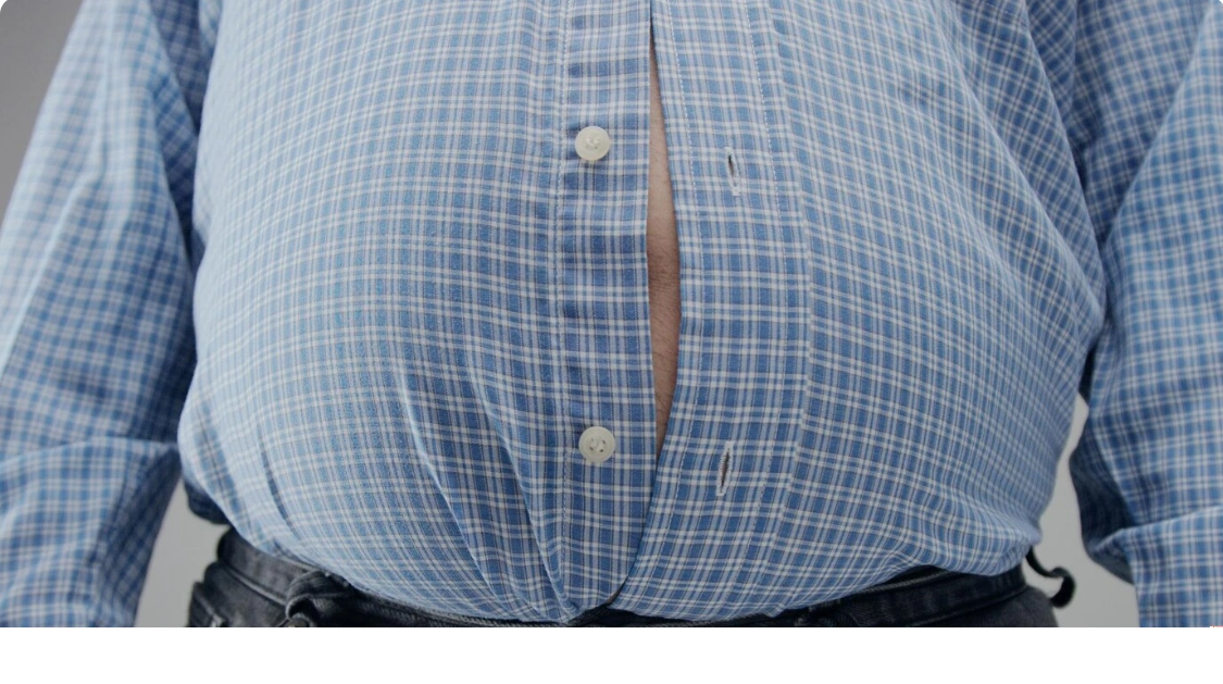 Gastric Sleeve Operation: A Life-Changing Weight Loss Journey Through Medical Travel