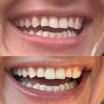 Empress Dental