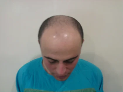 Mehmet Güçlü