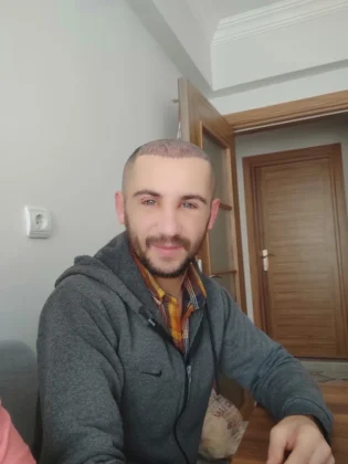 Avrupa Saç Ekimi Clinic