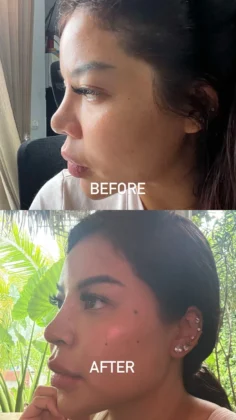 Phi Beauty Clinic