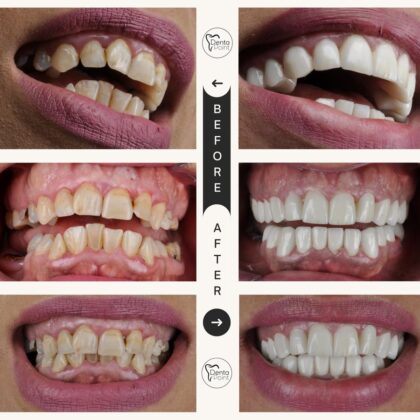 DentaPoint Dental Clinics