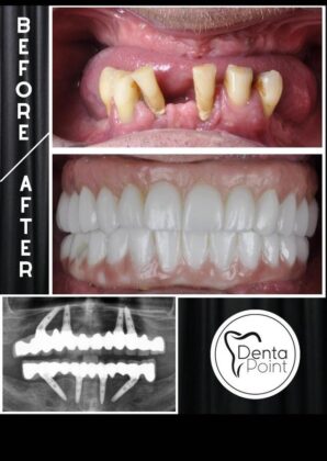 DentaPoint Dental Clinics