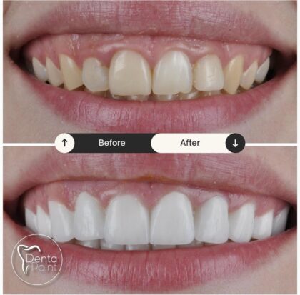 DentaPoint Dental Clinics