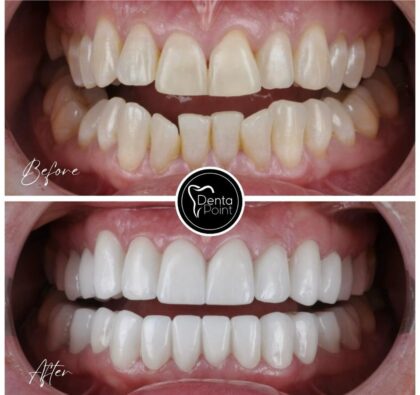DentaPoint Dental Clinics
