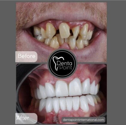 DentaPoint Dental Clinics