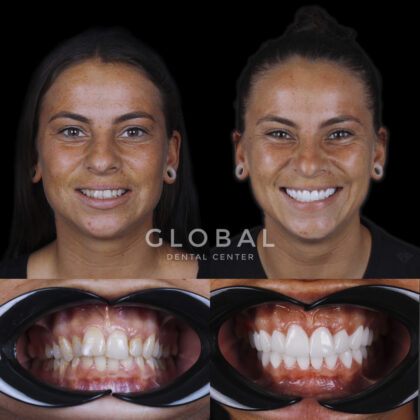 Global Dental Center