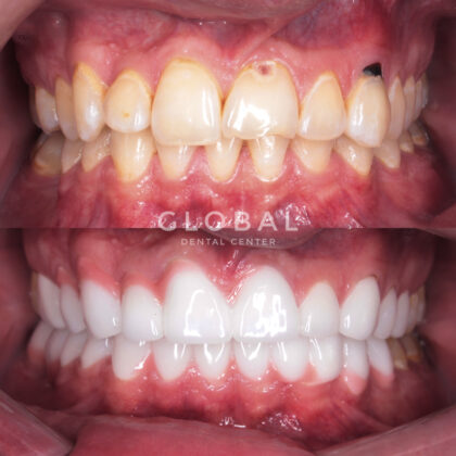 Global Dental Center