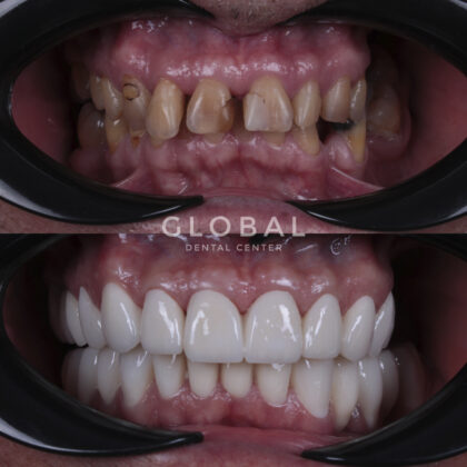 Global Dental Center
