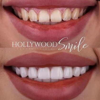 Hegazy Dental Clinic