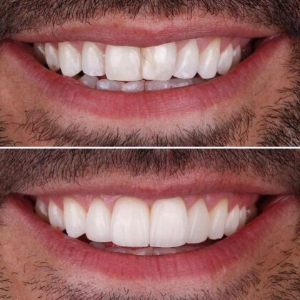 Hegazy Dental Clinic Hegazy Dental Clinic