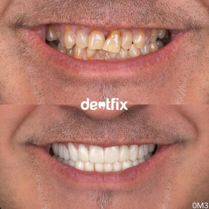 Dentfix Turkey Clinic
