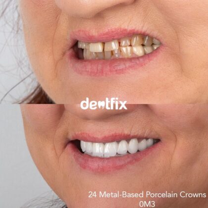 Dentfix Turkey Clinic
