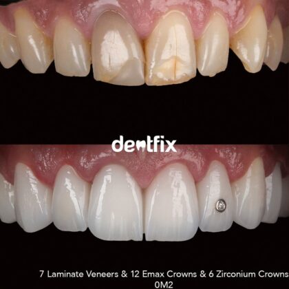 Dentfix Turkey Clinic