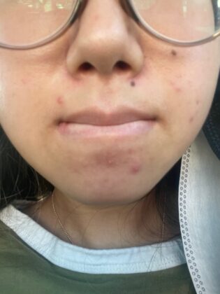 La Bella Cosmetic Surgery: Nga Dang MD