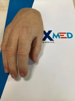 Luxmed Protez Clinic