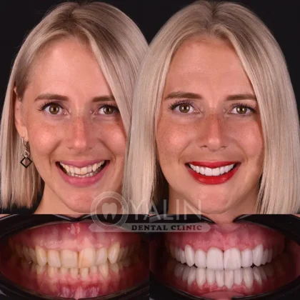 Yalın Dental Clinic