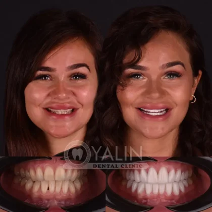 Yalın Dental Clinic